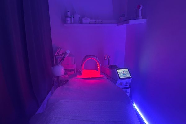 Microneedling